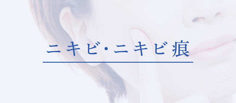 にきび・にきび跡