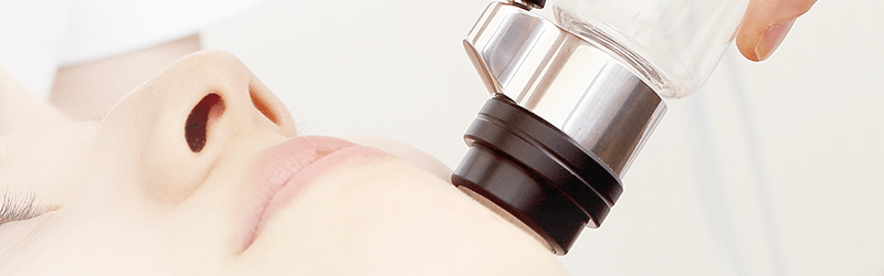 ダウンタイムのないエレクトロポレーション